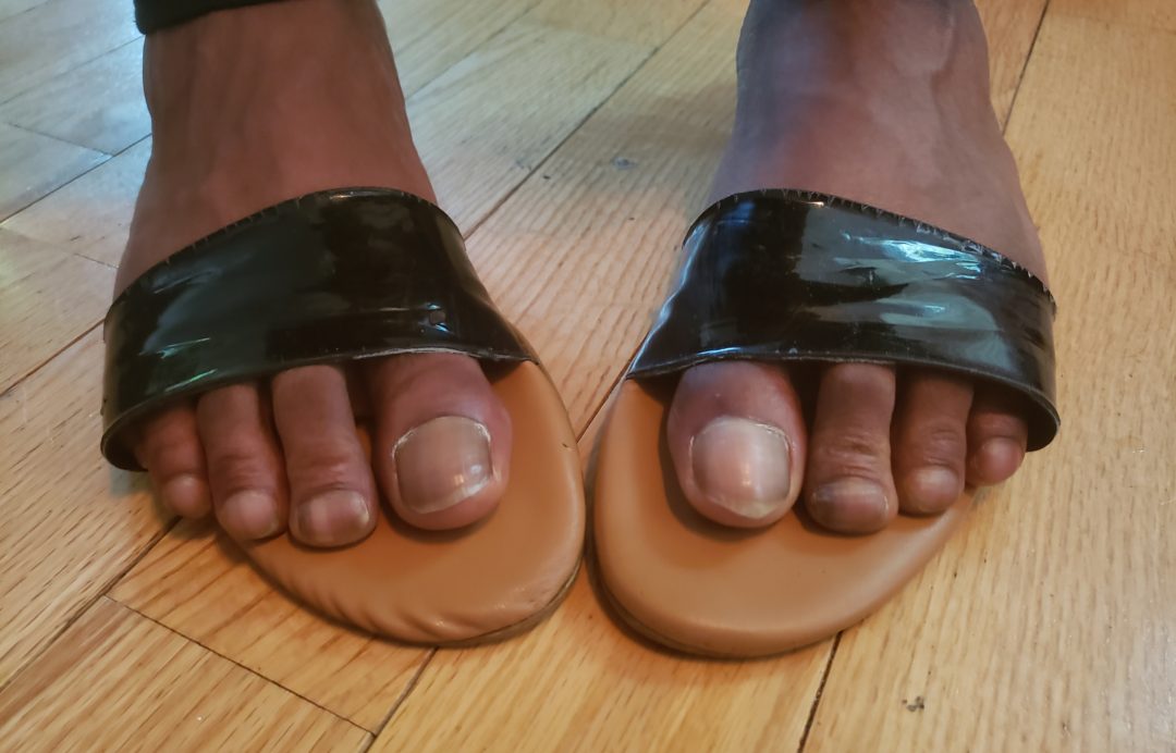 summer shoes for ugly feet